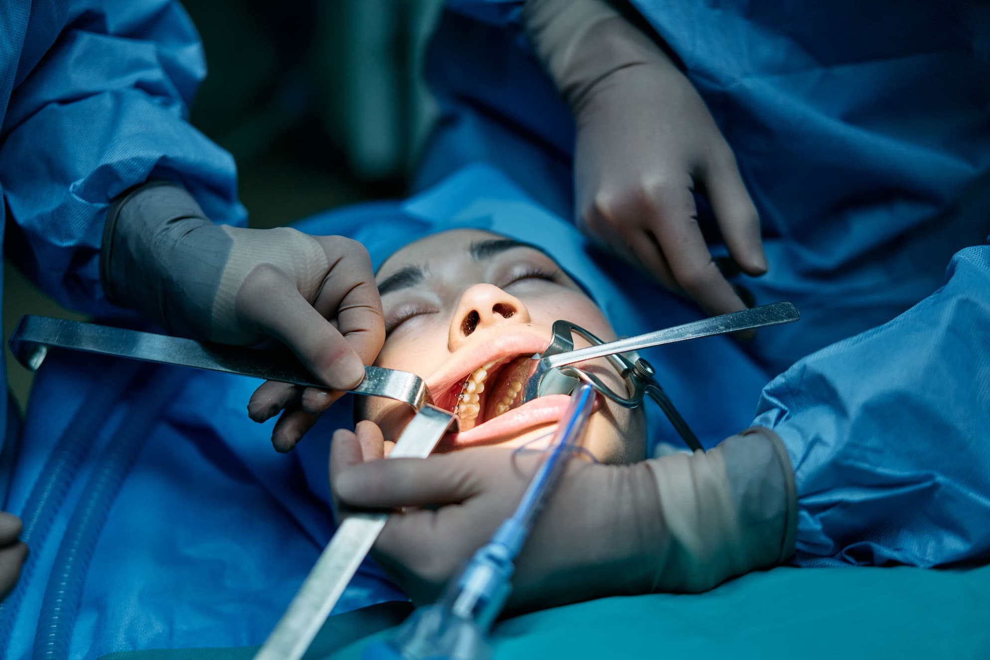 Chirurgie orală