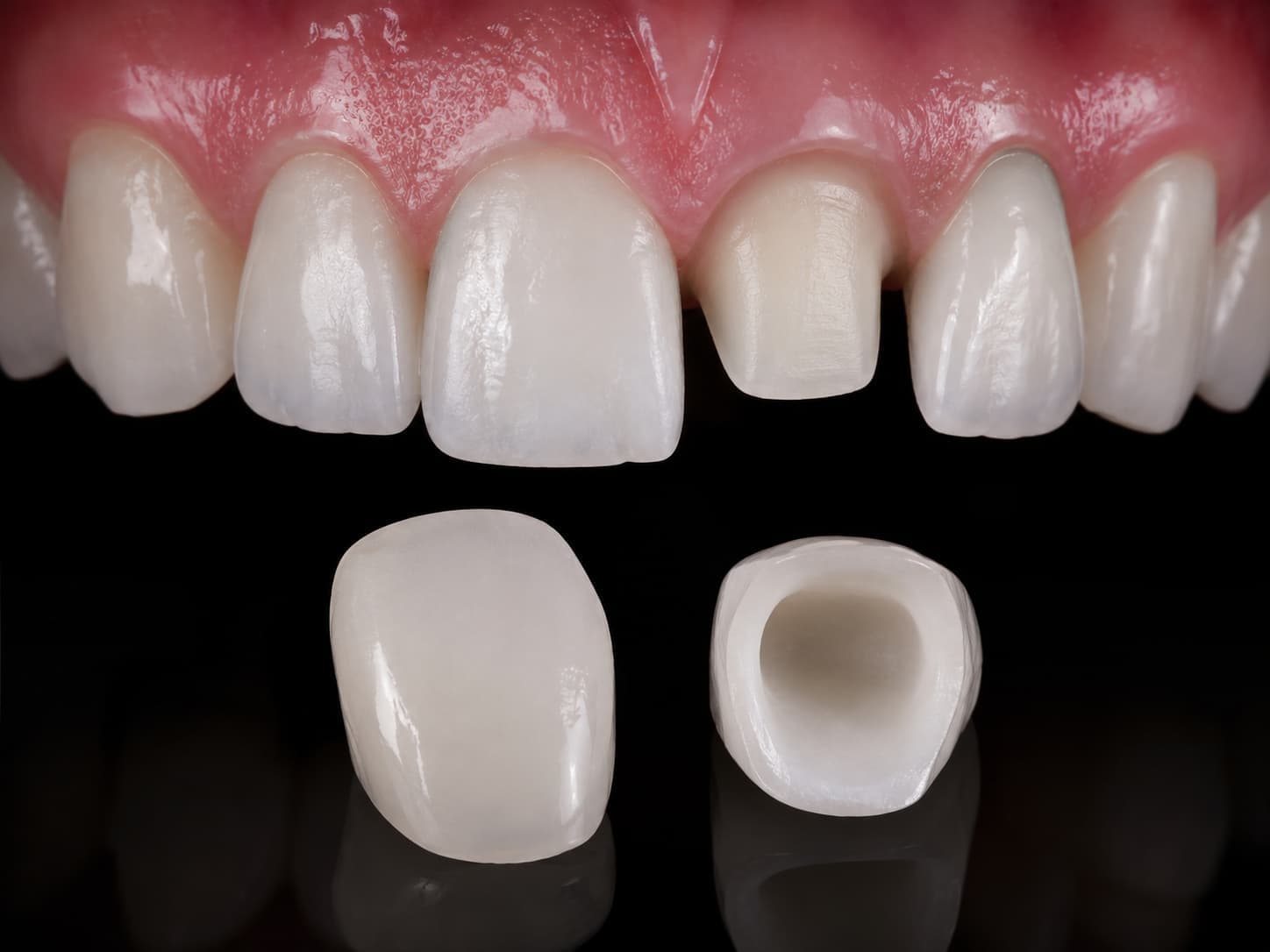 Protetică dentară